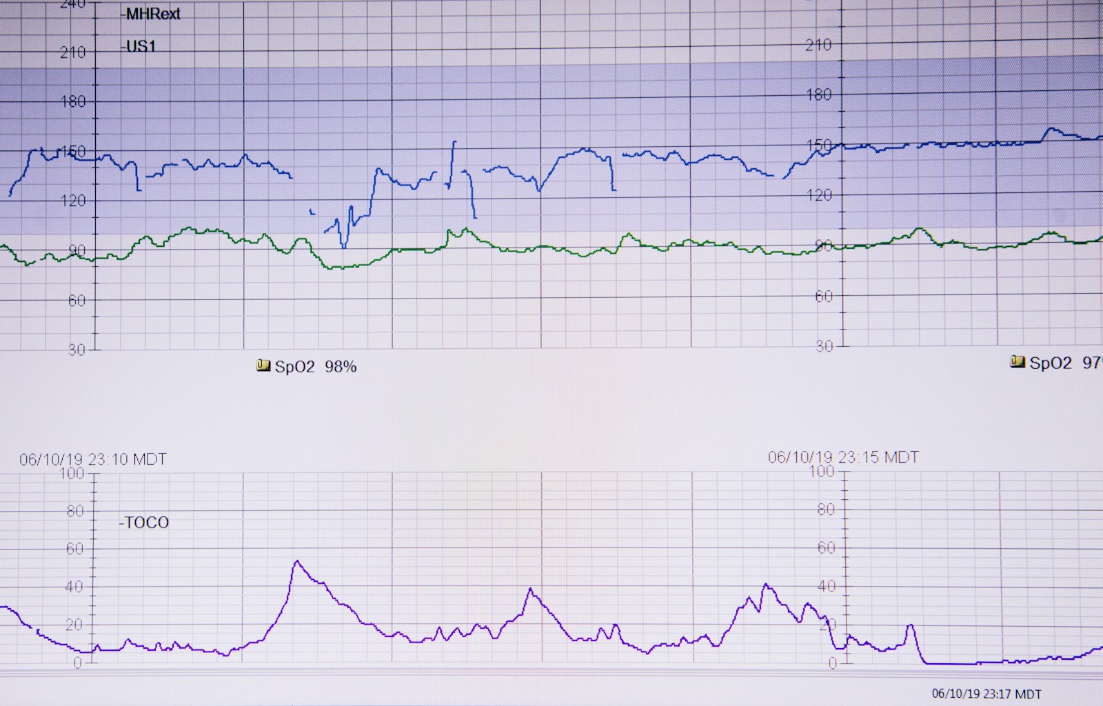 Prendre soin de soi pendant un traitement contre le cancer